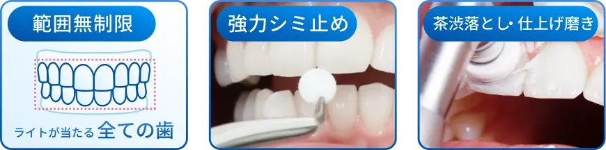 セット内容:範囲無制限、強力シミ止め、茶渋落とし/仕上げ磨き