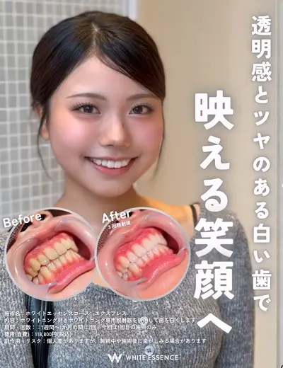ホワイトエッセンス公式Instagram