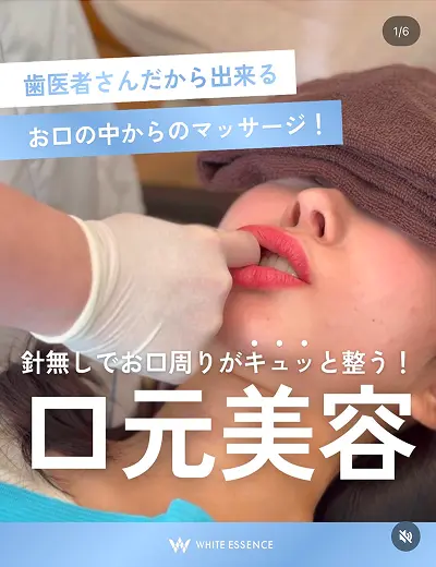 ホワイトエッセンス公式Instagram