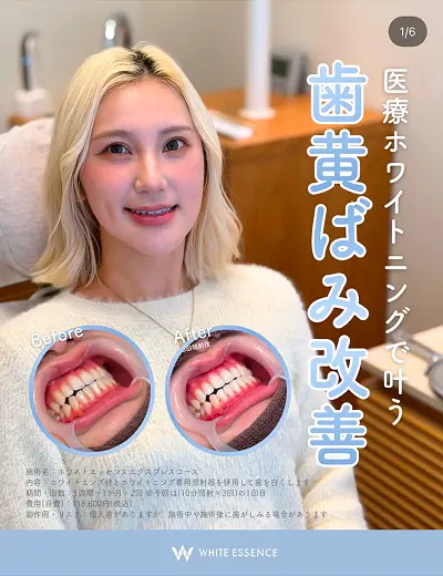ホワイトエッセンス公式Instagram