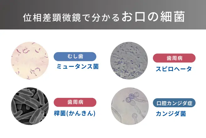 位相差顕微鏡でお口の細菌をチェック