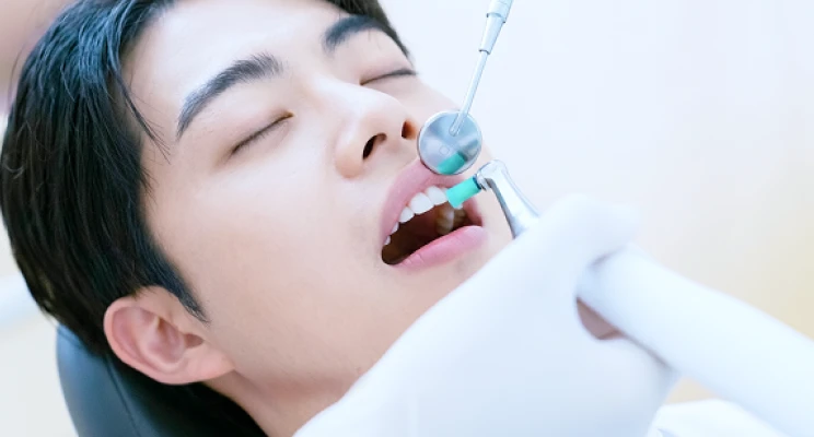 歯のクリーニングに関するよくある質問