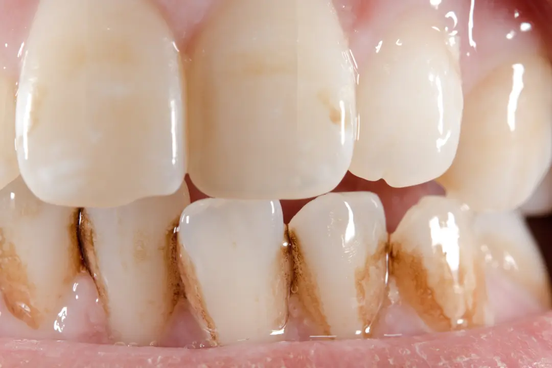 着色・ステインイメージ