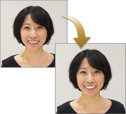 Smileup F ホワイトエッセンス Smileup F ホワイトエッセンス