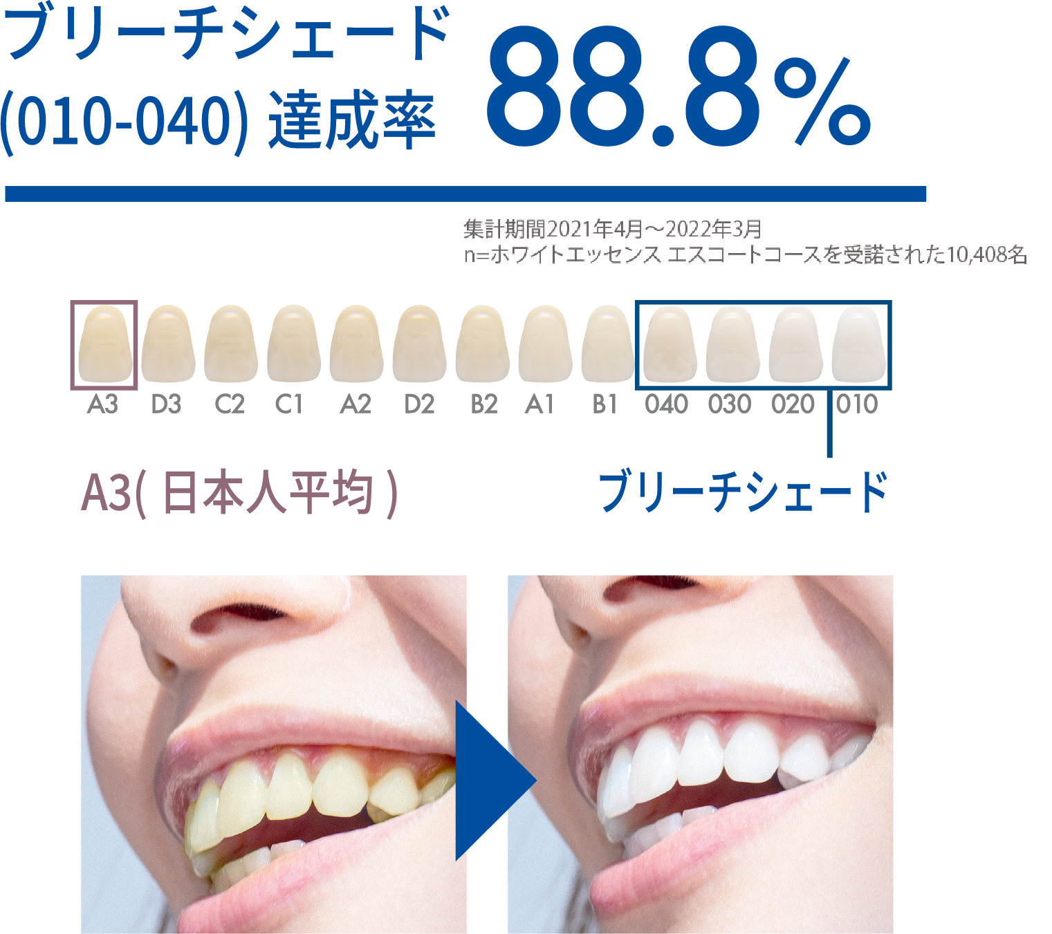 ブリーチシェード