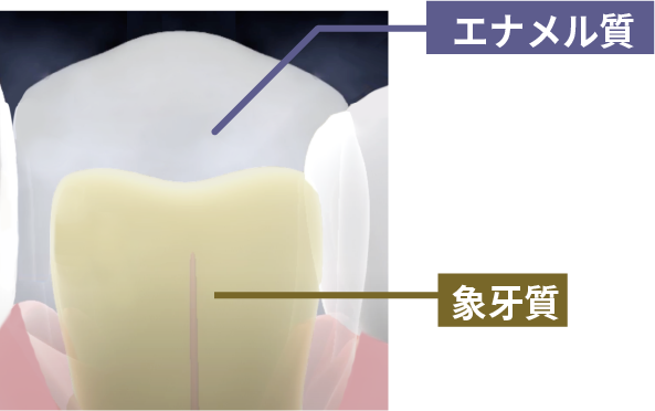 黄ばみ原因となるエナメル質と象牙質の色