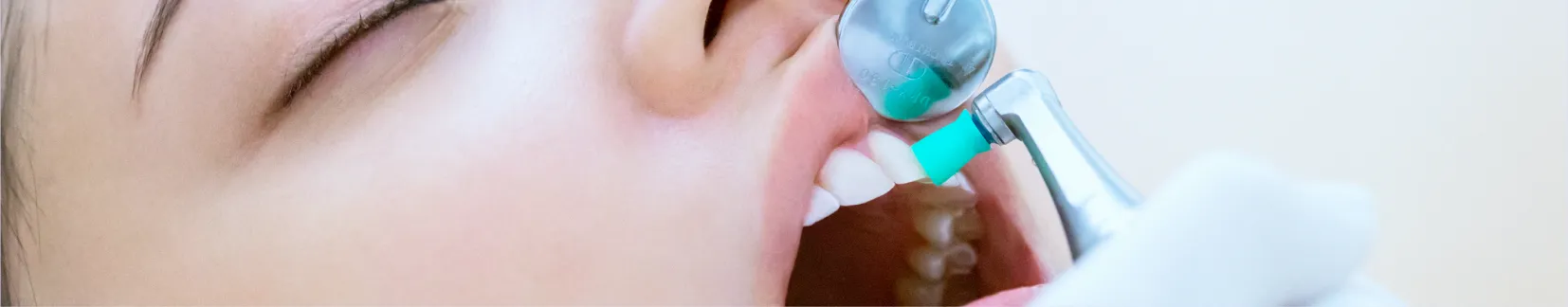 ホワイトニングのSTEP09