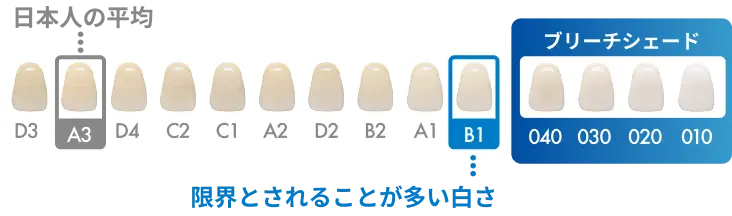 ブリーチシェードの白さイメージ
