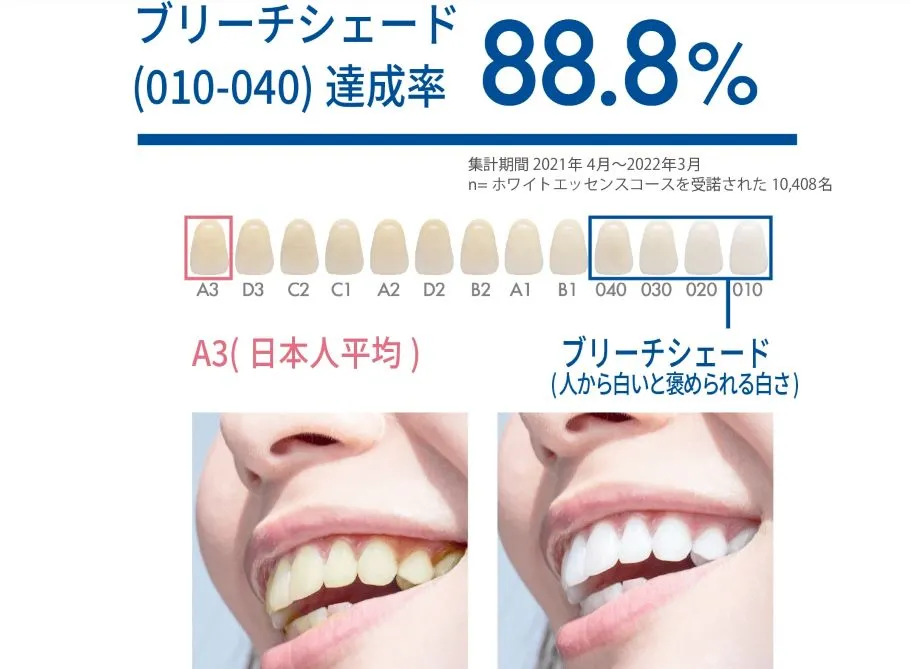 歯の白さを追求するホワイトニング