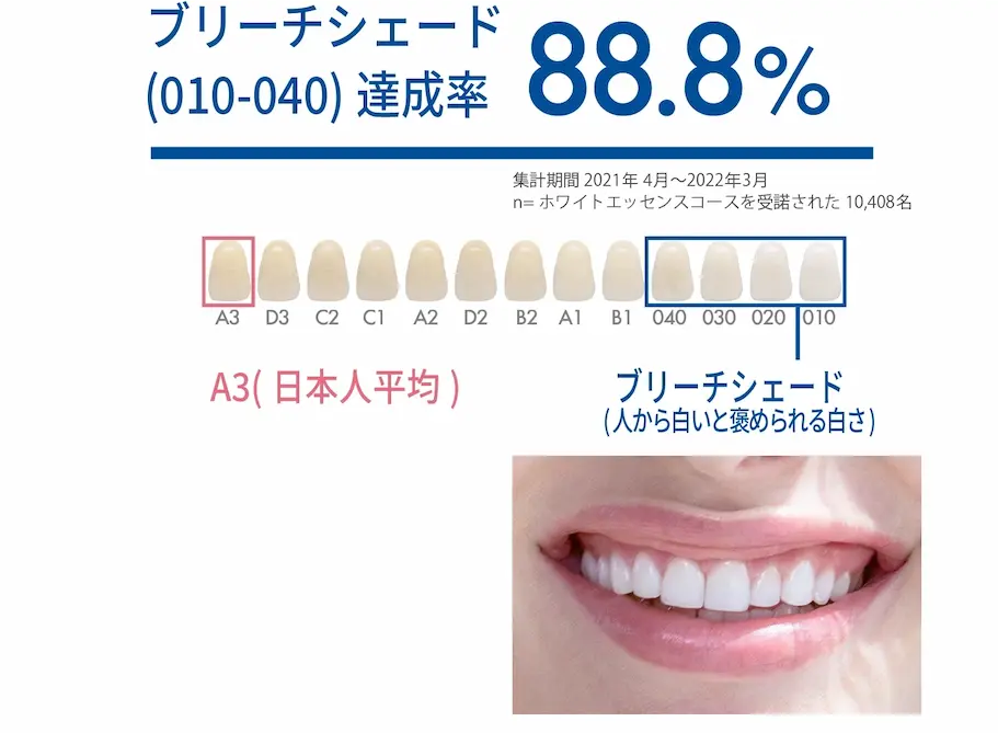 歯の白さを追求するホワイトニング