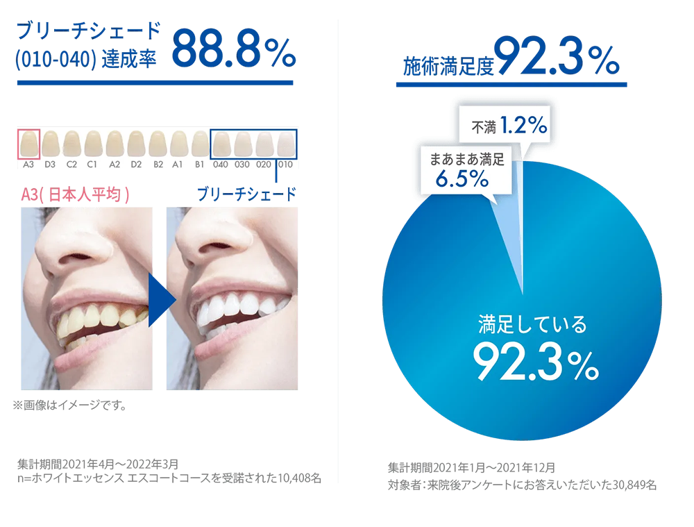 歯の白さを追求するホワイトニング