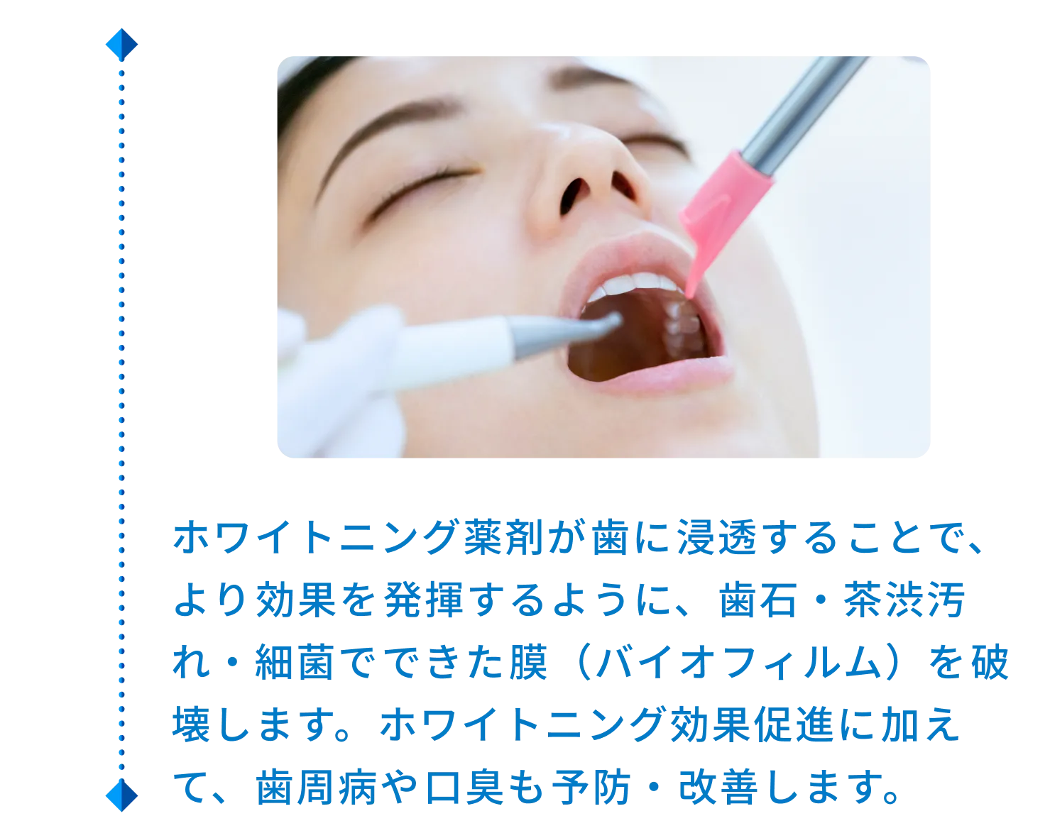 ホワイトニング薬剤が歯に浸透することで、より効果を発揮するように、歯石・茶渋汚れ・細菌でできた膜（バイオフィルム）を破壊します。ホワイトニング効果促進に加えて、歯周病や口臭も予防・改善します。
