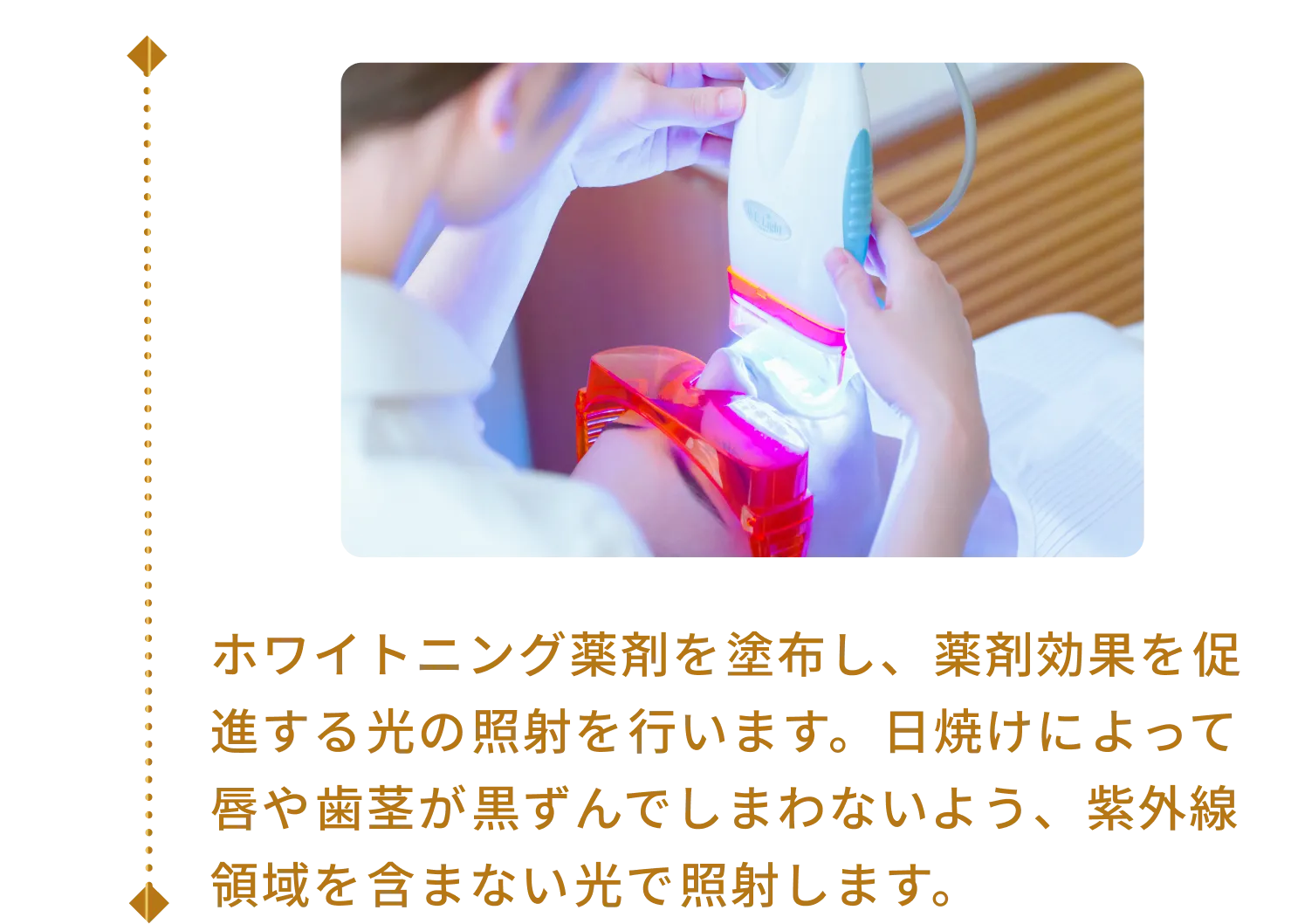 ホワイトニング薬剤を塗布し、薬剤効果を促進する光の照射を行います。日焼けによって唇や歯茎が黒ずんでしまわないよう、紫外線領域を含まない光で照射します。