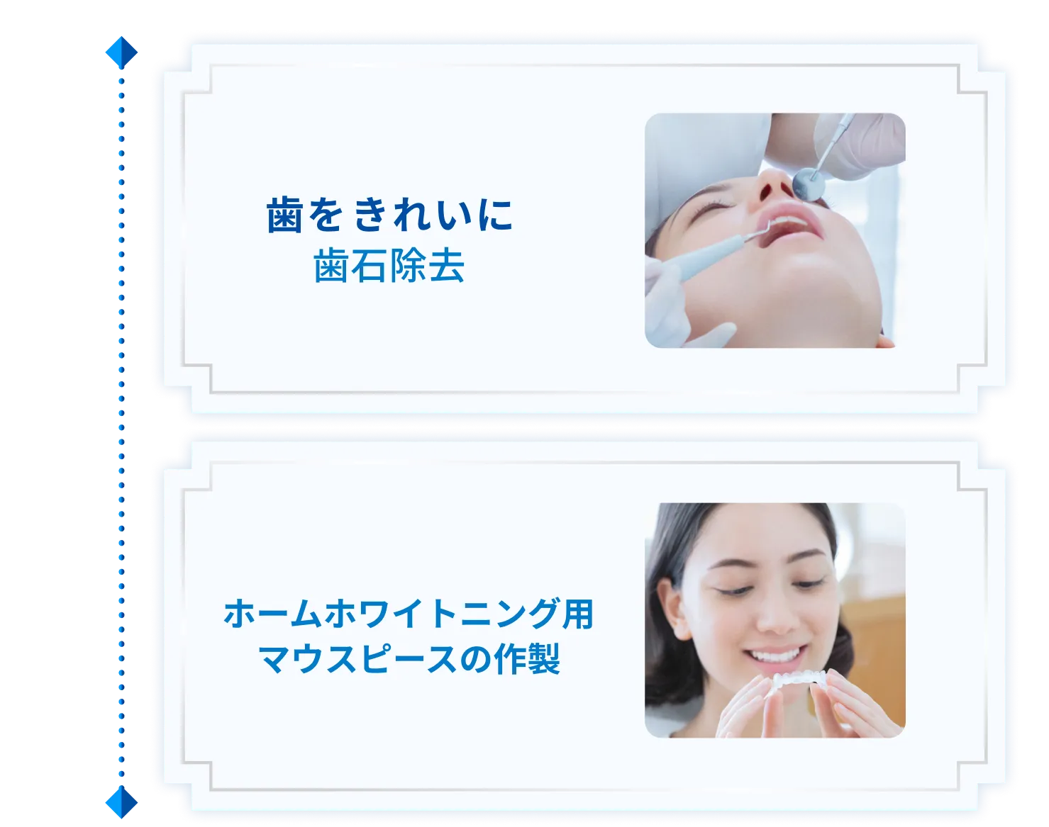 歯をきれいに歯石除去 ホームホワイトニング用マウスピースの作製