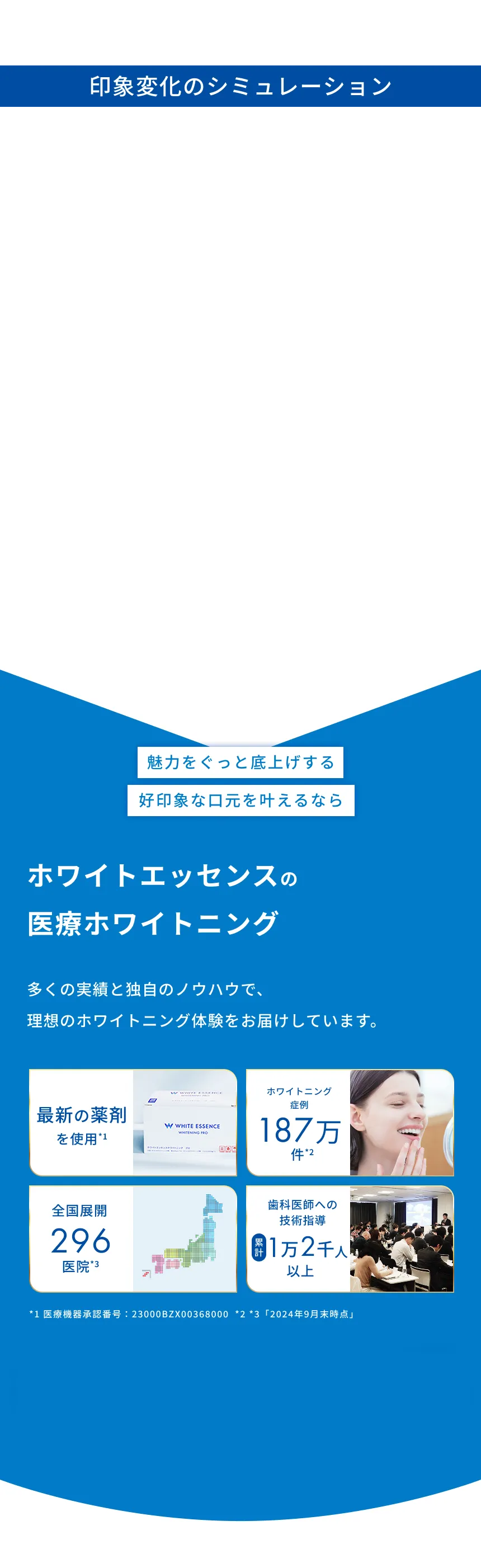 歯の色が変わると顔の印象もこんなに変化！ホワイトエッセンスの医療ホワイトニング