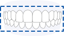 全ての歯