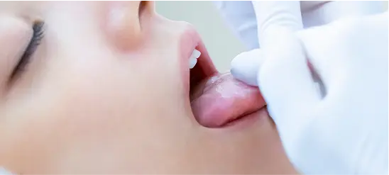 施術イメージ