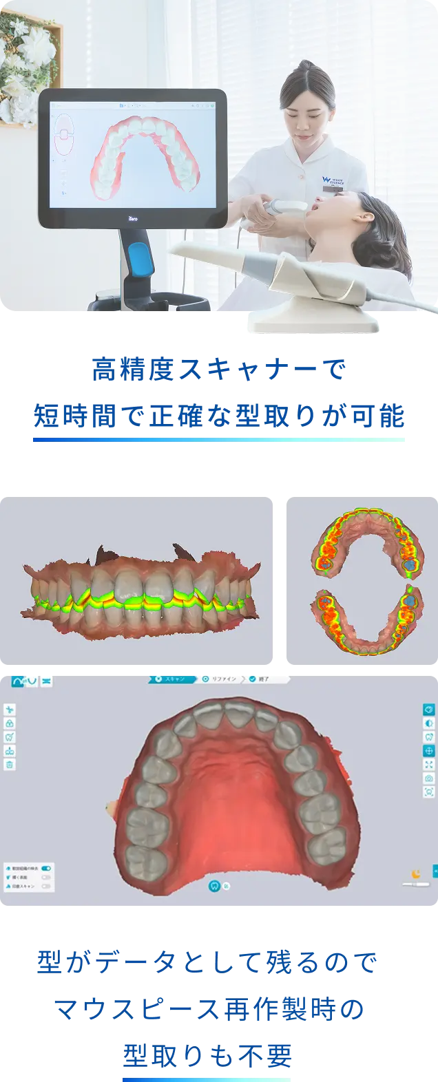 高精度スキャナーで短時間で正確な型取りが可能