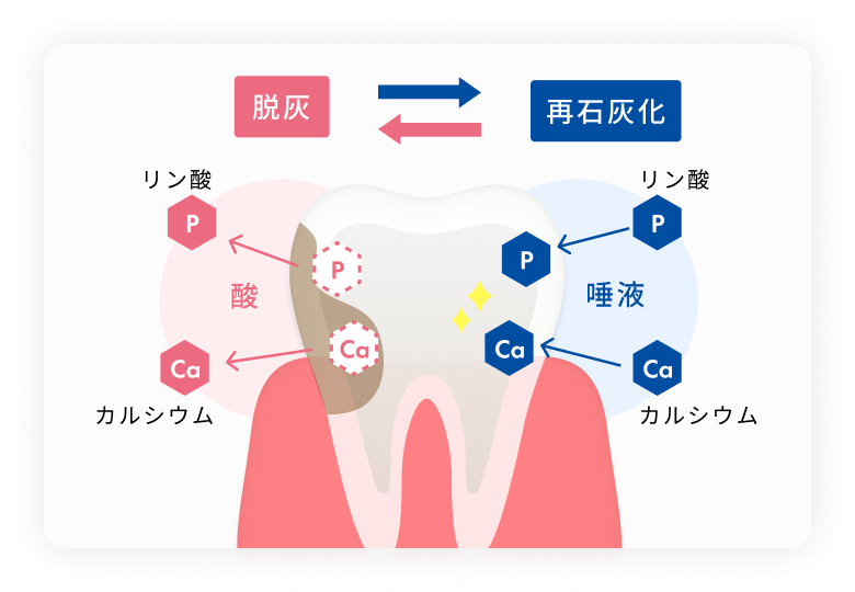 酸性のホワイトニング薬剤は脱灰を引き起こすことで、知覚過敏を引きおこす