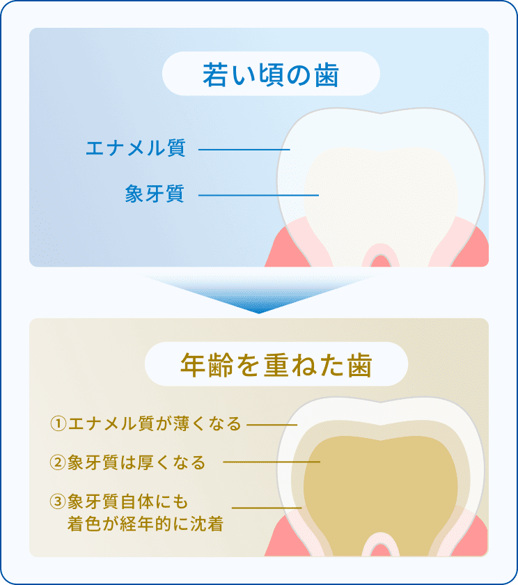 歯の黄ばみの正体は歯の内部（象牙質）