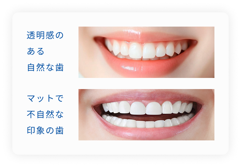 透明感のある自然な白さとマットで不自然な白さ