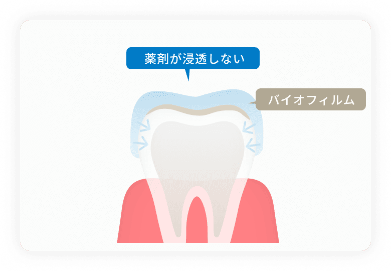 薬剤の浸透不足（汚れのバリア）