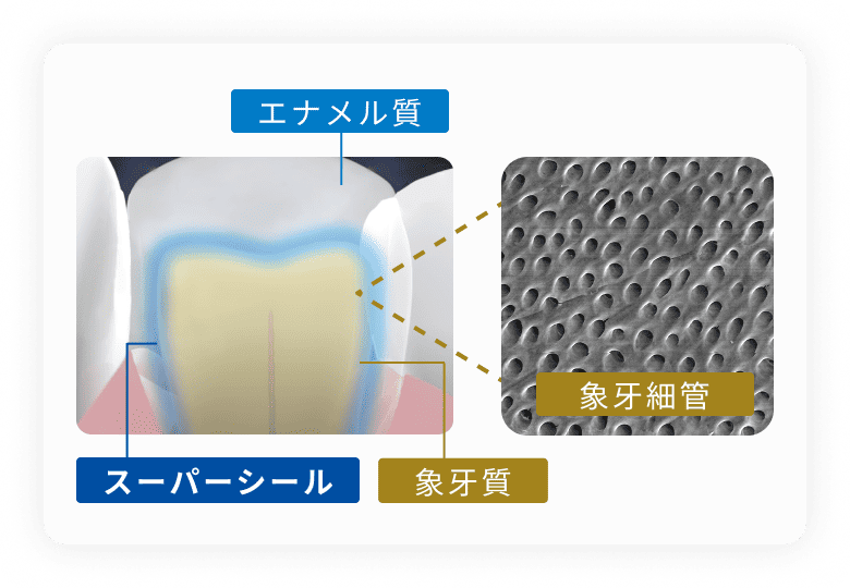 痛み対策に特化したスーパーシール