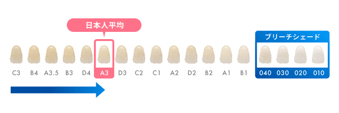 歯の表面の汚れ落としで目指せる白さ