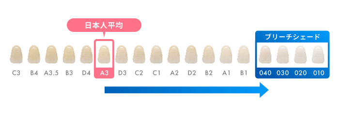 歯の内部の黄ばみ分解で目指せる白さ