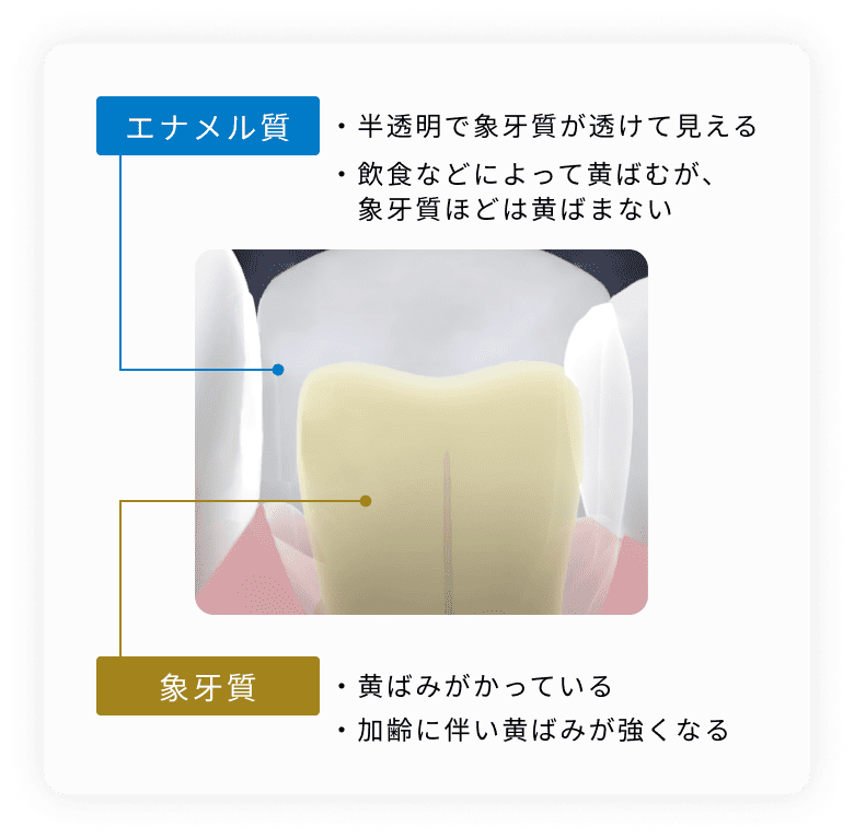 歯の内部の黄ばみ