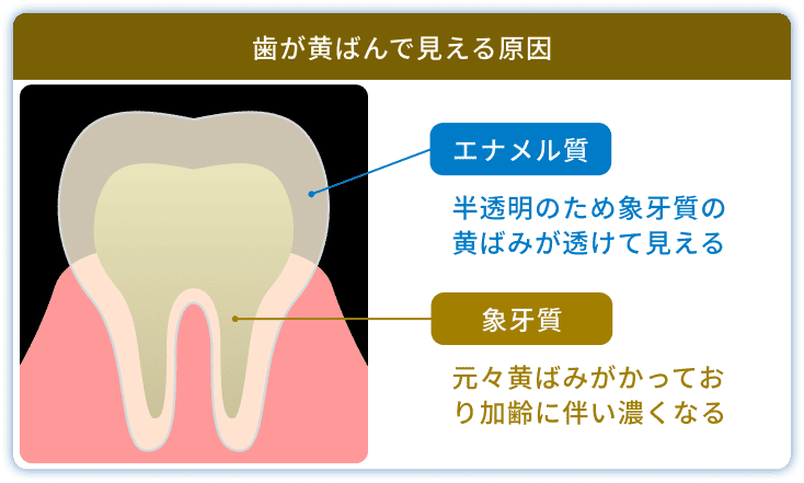 歯が黄ばんで見える原因