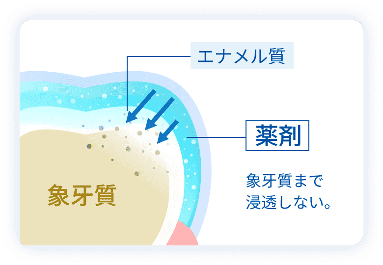 薬剤がエナメル質までしか作用しない