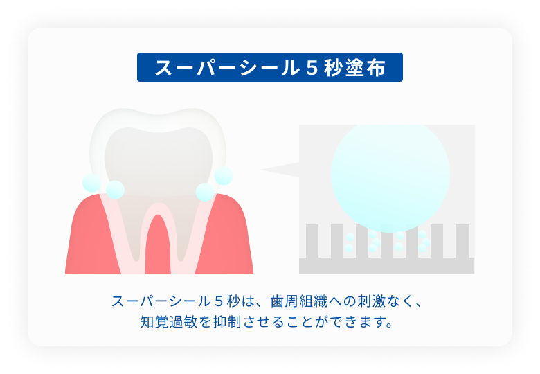 しみ止めで知覚過敏対策