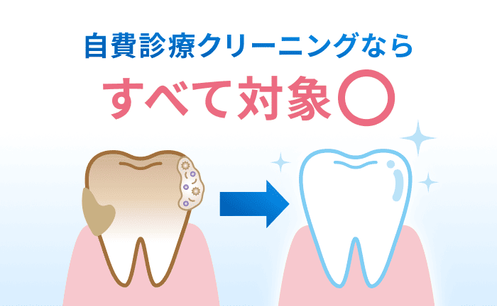 歯のヤニ除去なら自費クリーニング