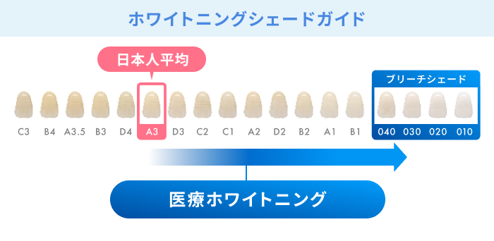 ホワイトニングの効果の一つである「歯の本来以上の白さ」はA3以上の白さが期待できる