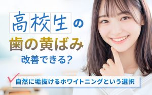 高校生の歯の黄ばみを改善できる？自然に垢抜けするホワイトニングという選択肢