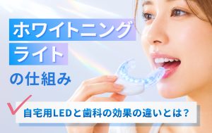 ホワイトニングライトの仕組み。自宅用LEDと歯科の効果の違いとは？