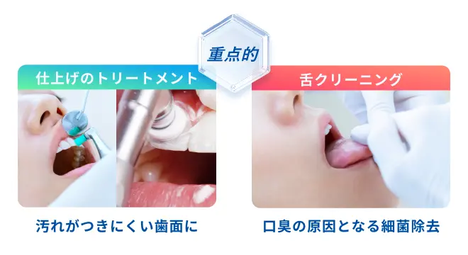 「汚れがつきにくい歯面に」、「口臭の原因となる細菌除去」を重点的に