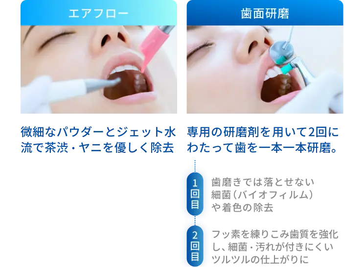 エアフローでは微細なパウダーとジェット水流で茶渋・ヤニを優しく除去、歯面研磨では専用の研磨剤を用いて2回にわたって歯を一本一本研磨