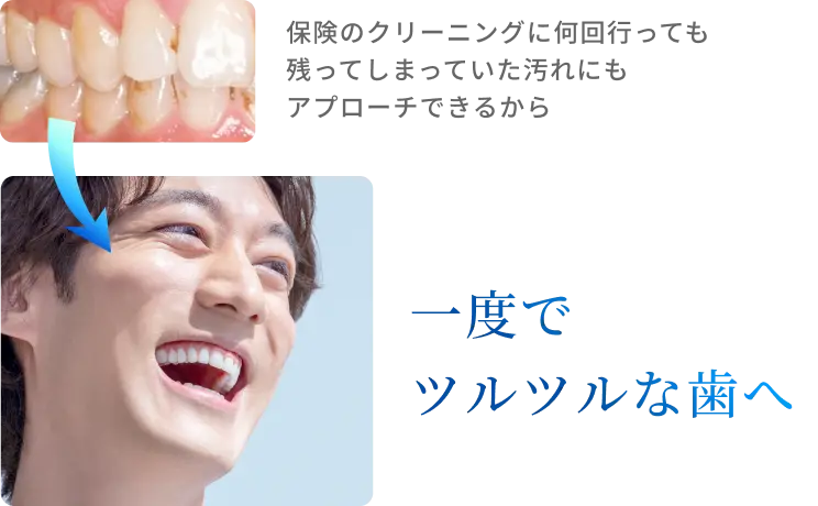 一度でツルツルな歯へ