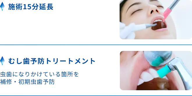 施術15分延長、むし歯予防トリートメント