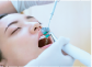 歯のクリーニング工程のPMTC（歯面研磨）の画像