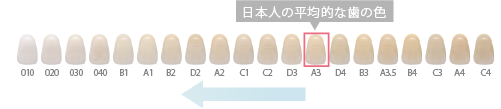 日本人の平均的な歯の色