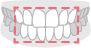 ホワイトニング施術範囲