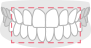 ホワイトニング施術範囲