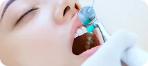 歯面研磨