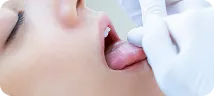 舌クリーニング