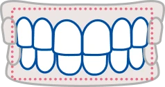 施術範囲