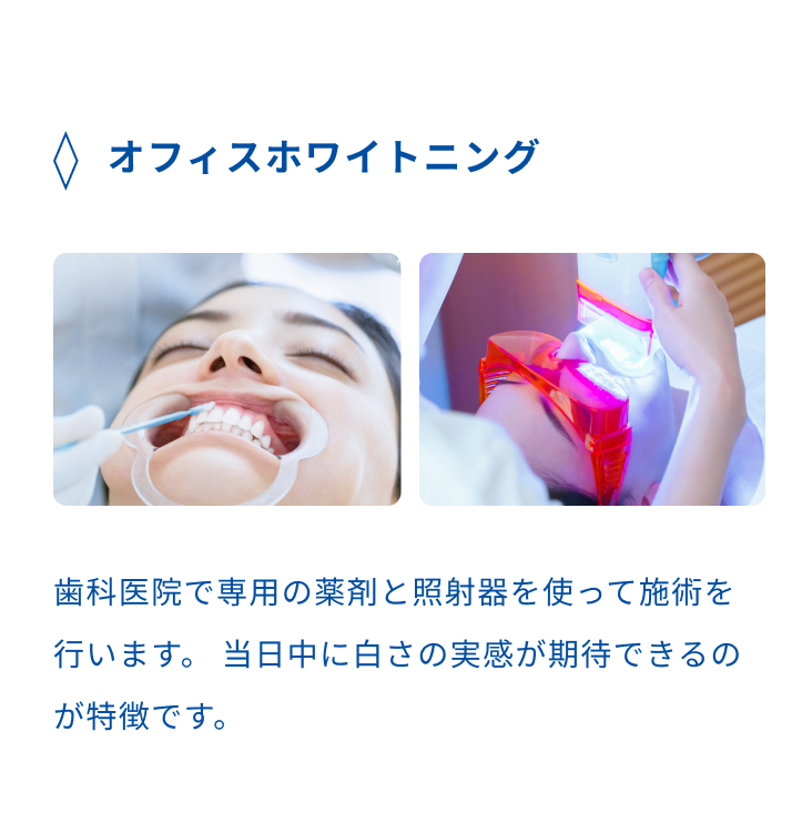オフィスホワイトニング