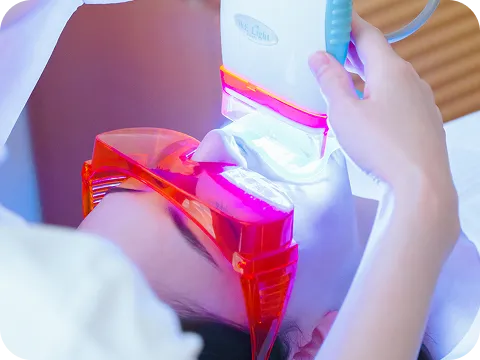 オフィスホワイトニング施術イメージ